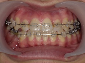 SHOFU DENTAL DIGITAL CAMERA