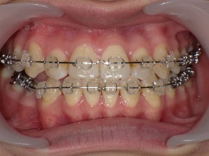 SHOFU DENTAL DIGITAL CAMERA